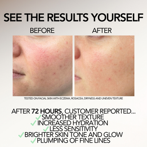Relief Serum