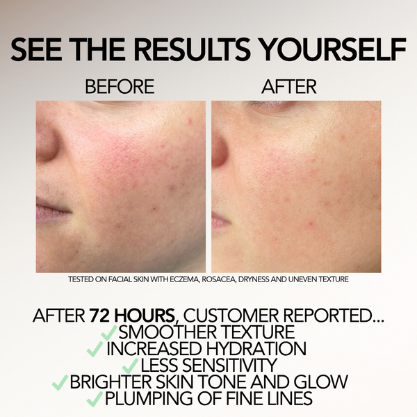 Relief Serum